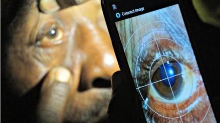 Peek, la aplicación que permite diagnosticar problemas oculares con el móvil