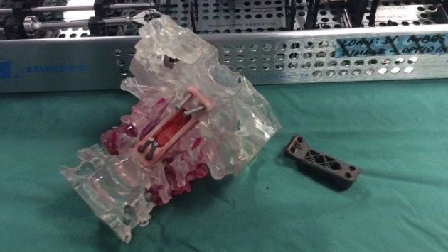 3d Printed Vertebrae 01