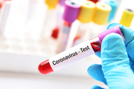 coronavirus