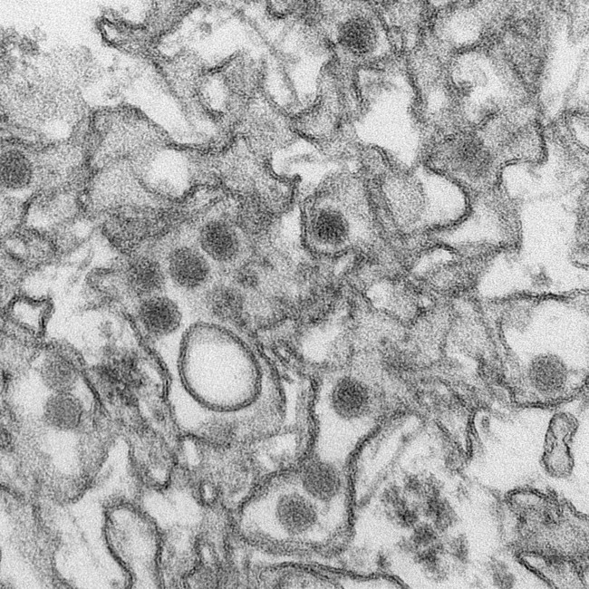 Zika Em Cdc 280116