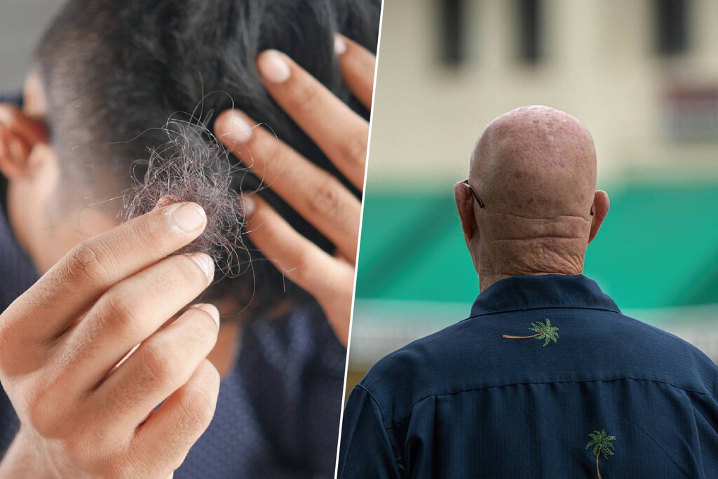 Há anos ouvimos dizer que lavar o cabelo em excesso causa queda, mas é exatamente o contrário