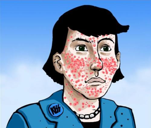 JERAWAT MERAH MERADANG 