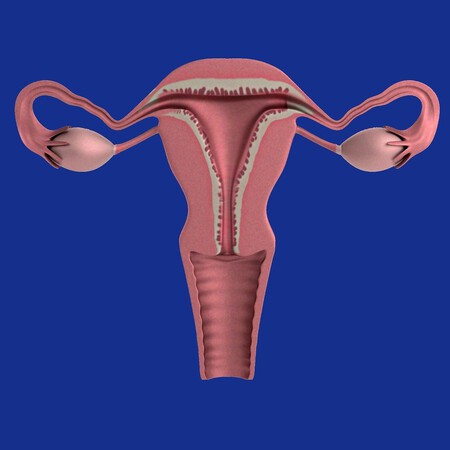 pólipos endometriales