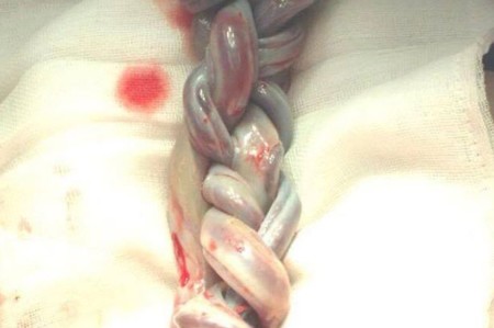 Cordones