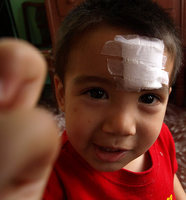 ¿Cómo actuar en caso de accidente doméstico (I)?: Heridas.