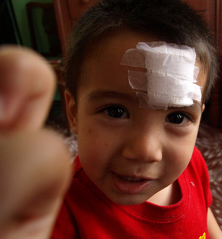 ¿Cómo actuar en caso de accidente doméstico (I)?: Heridas.