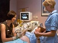 La amniocentesis, una confirmación