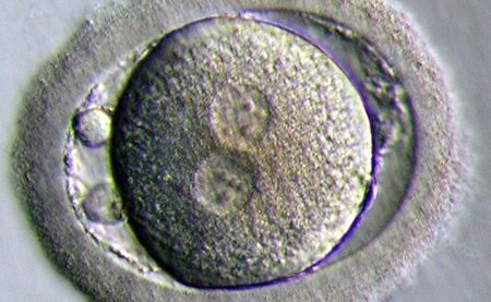 El descubrimiento de células madre en el ovario, gran avance contra la infertilidad