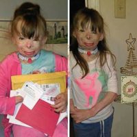 El conmovedor deseo de Navidad de una niña que perdió a su familia en un incendio