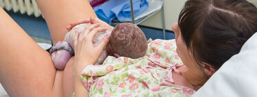 Episiotomía en el parto: ¿van a hacerme este corte en el perineo?  