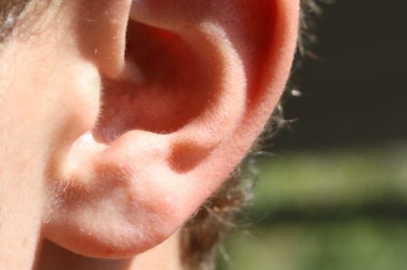 Otro indicador de riesgo cardiovascular: surco en el lóbulo de la oreja