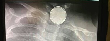 Una madre advierte sobre los peligros de las pilas de botón después de que su hija falleciera al tragarse una