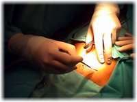 Incremento de cesáreas por miedo de los médicos a posibles denuncias