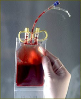 La leucemia infantil tratada con células madre del cordón umbilical ofrece mayor supervivencia