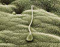 A más edad del padre, mayor riesgo de aborto