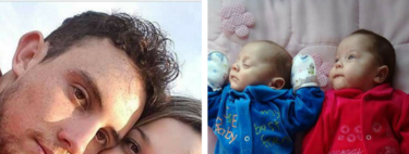 Mantienen con vida durante 123 días a una mujer embarazada con muerte cerebral para que sus mellizos pudieran nacer 