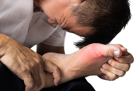 Ácido úrico: ¿protector o factor de riesgo? Todo lo que necesitas saber
