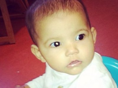 Otro bebé es diagnosticado de un cáncer gracias a una foto con flash