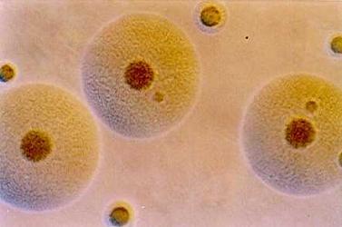 Bacterias que intercambian material genético para ser más virulentas