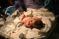 Factores de riesgo perinatales