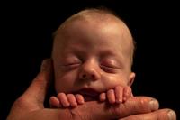 Los bebés prematuros corren cinco veces más riesgo de desarrollar autismo