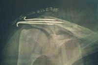 Sam Lowes se fractura la clavícula en los entrenamientos de Jerez 