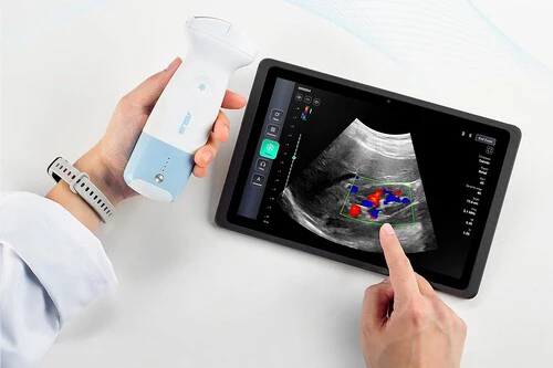 Ecografías Móvil Portada