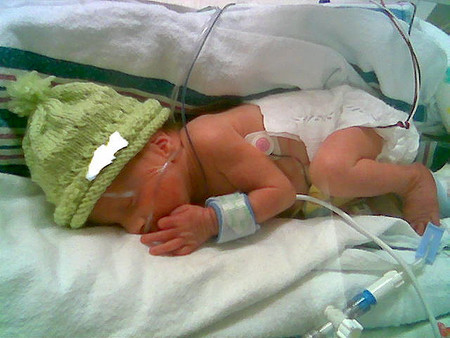 Cómo influye el ambiente de la Unidad de Cuidados Intensivos Neonatal en el bebé