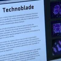 Brasileiro cria IA que ajuda a diagnosticar doença de chagas 