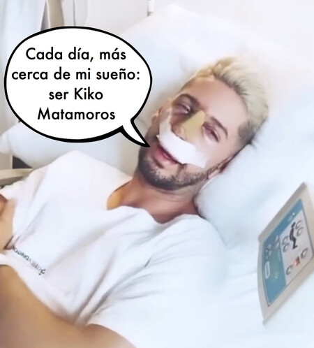 Lester ('La Isla de las Tentaciones') vuelve al quirófano para cambiar de nariz y estas son las impactantes imágenes de su resultado
