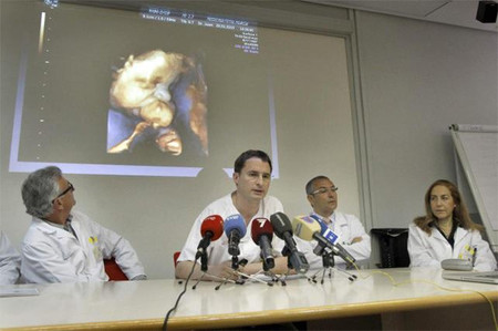 Extirpan un tumor en la cara a un bebé antes de cortar el cordón