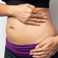 La piel en el postparto: cómo cambia y cómo debemos cuidarla