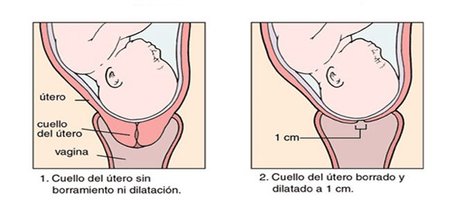 Resultado de imagen de medicion cuello utero