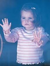 Los síntomas de asma los padecen el 15% de los niños españoles mayores de 4 años