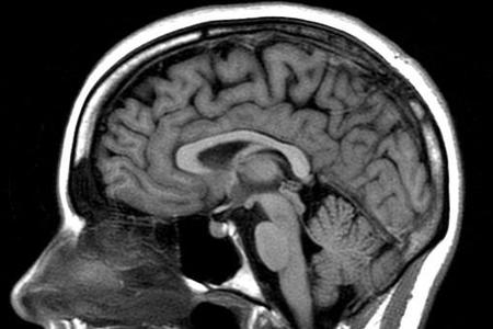 El Cerebro, evolución y funcionamiento (I)