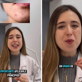 Leire Barrutia, dermatóloga: "si nos ha salido un grano inflamado, este es el principio activo sin receta médica que nos puede ayudar mucho"