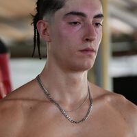 El rival más duro de Plex no es un luchador de La Velada. El youtuber se pelea contra un canguro en Tailandia y este le deja un recuerdo a su vuelta a España 