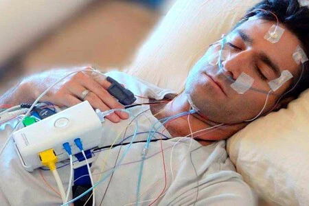 睡眠ポリグラフィーは病院で実施され、睡眠時無呼吸を検出します(画像:Geomedica)