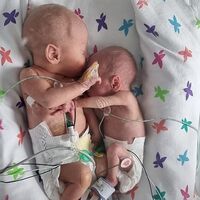 La emotiva imagen de dos gemelos abrazados y cogidos de la mano, tras encontrarse por primera vez dos semanas después de nacer