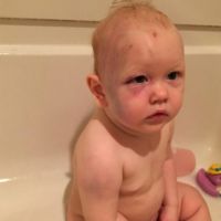 Un padre publica en Facebook la foto de su bebé golpeado por su cuidador para pedir justicia