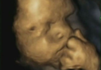 ¿Cómo son los gestos del bebé dentro del vientre de una madre estresada? 