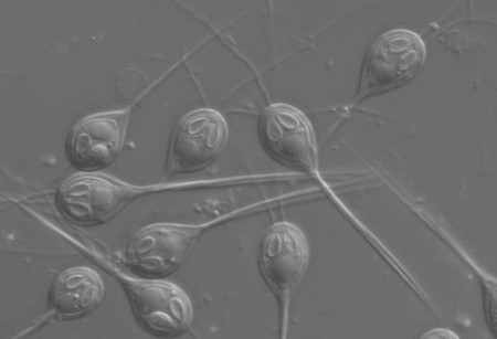 Este parásito microscópico no necesita oxígeno para sobrevivir en el fondo del mar