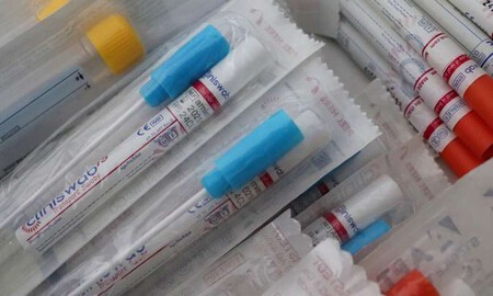 Se desarrolla una nueva prueba para el COVID-19 más precisa y que solo dura 5 minutos