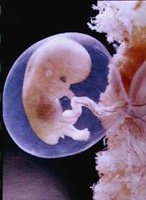 El líquido amniótico y lo que debemos saber