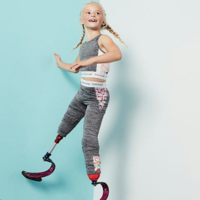 Con siete años, esta niña modelo sin piernas es todo un ejemplo de superación