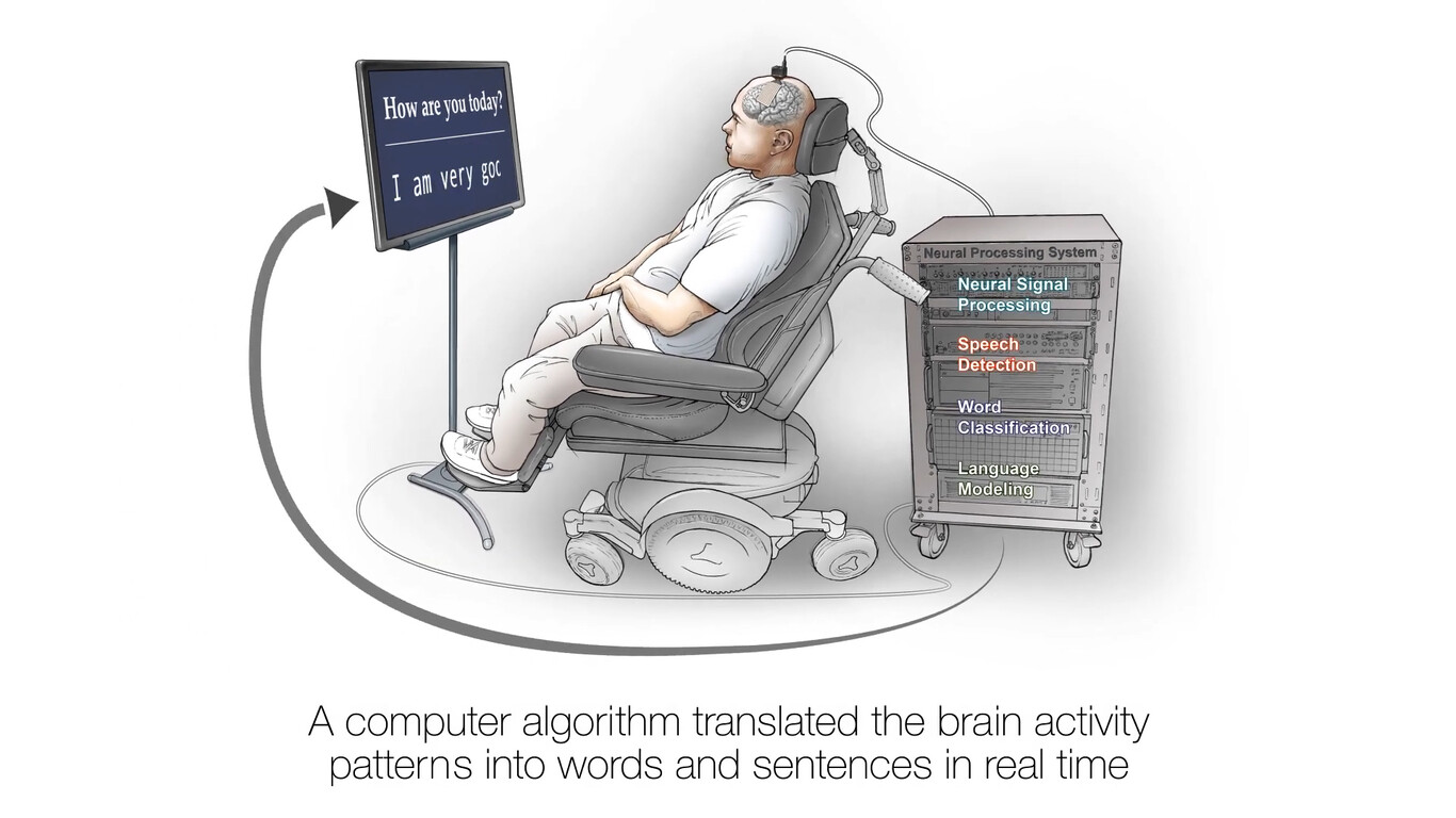 Neuroprosthesis Restores Words To Man With Paralysis 00 00 51 21 Imagen Fija004
