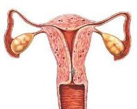 Problemas que pueden afectar al útero