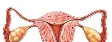 Problemas que pueden afectar al útero