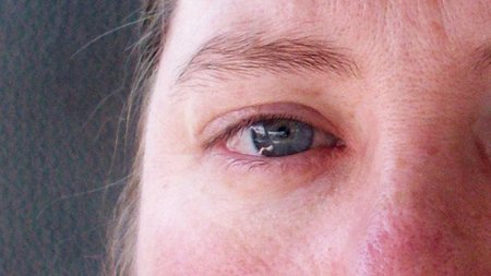 Recuerda que los ojos también pueden sufrir quemaduras solares