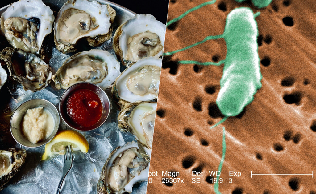 Qué es la "bacteria carnívora” y por qué Europa cree que ahora es el mejor momento para extremar precauciones